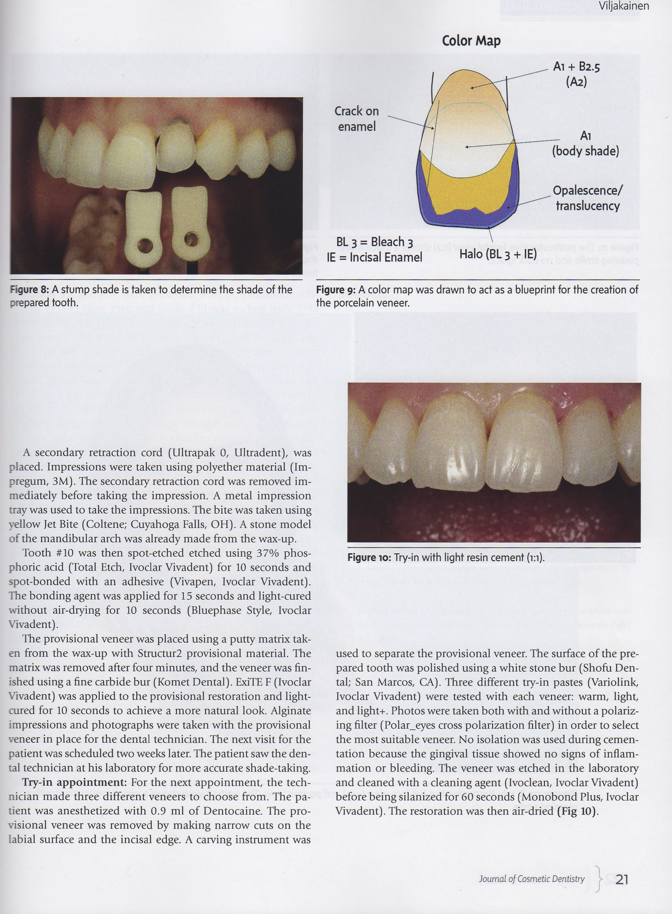 Esteettinen hammashoito Helsinki hampaat ennen