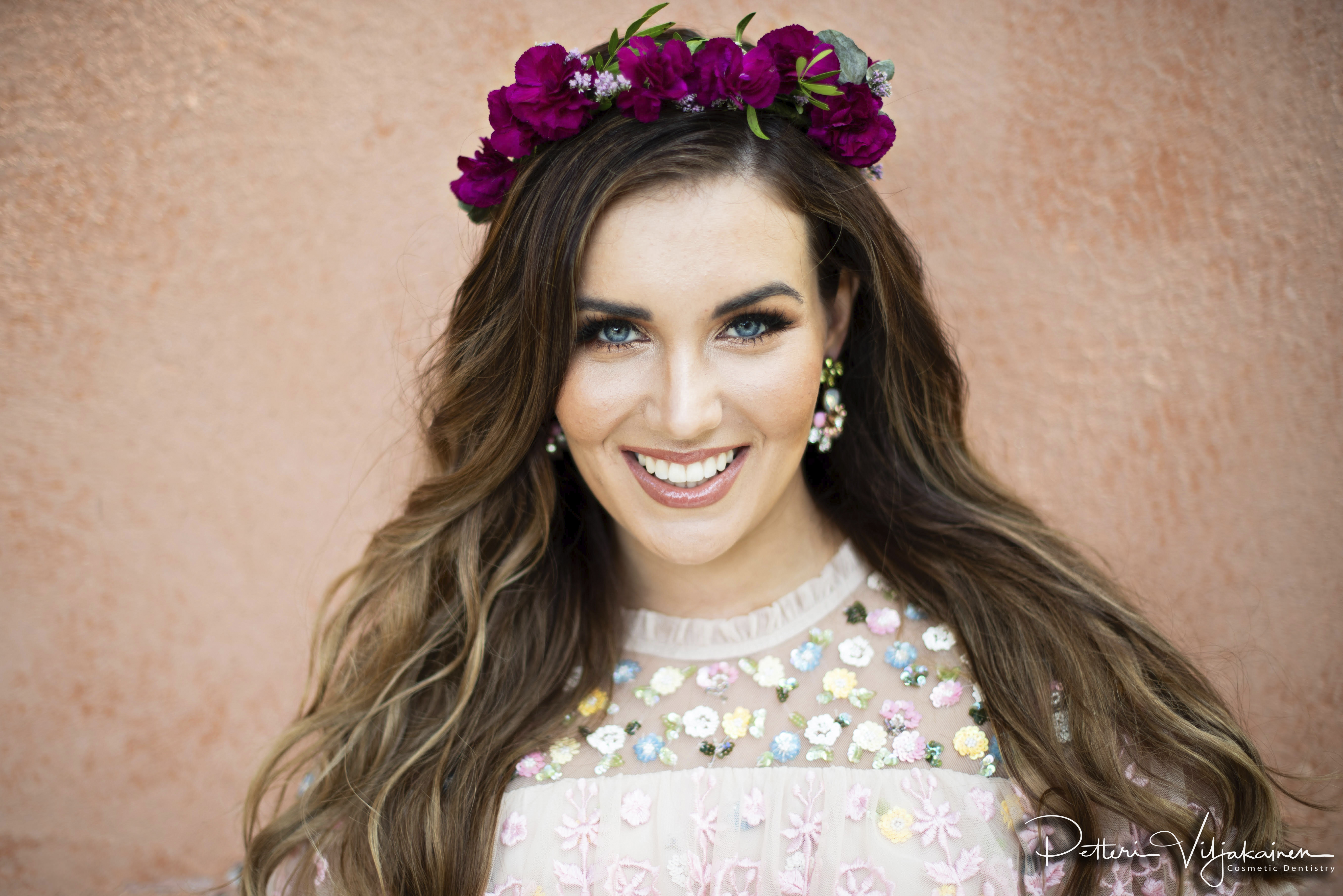 Esteettinen hammashoito Helsinki. Kaunis hymy 