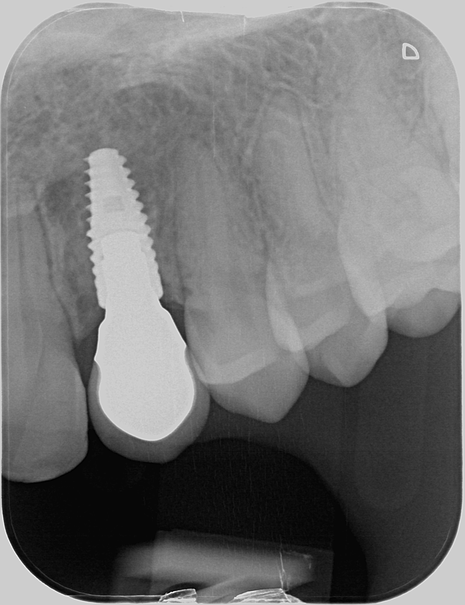 Esteettinen hammashoito Helsinki hampaat ennen