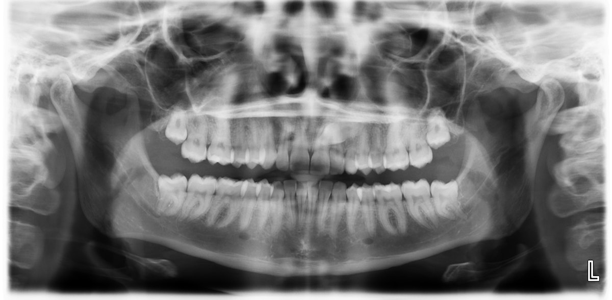 Esteettinen hammashoito Helsinki hampaat ennen