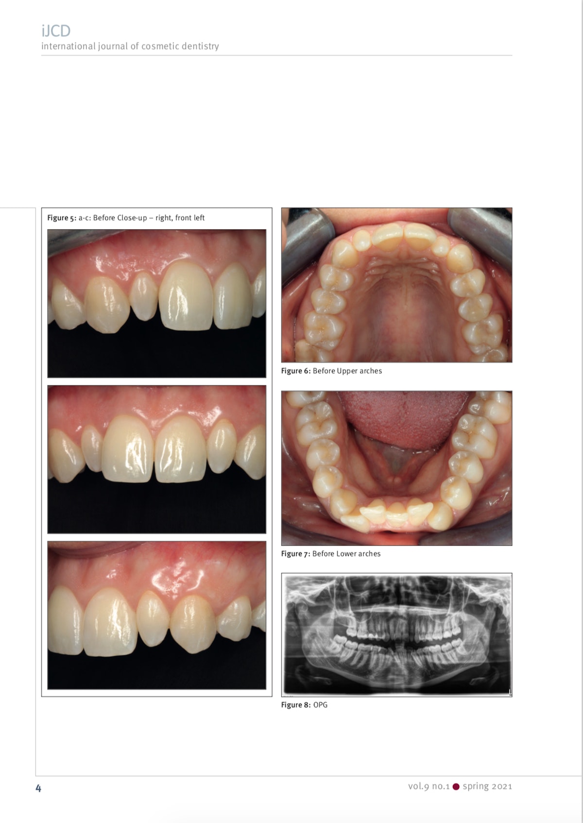 Esteettinen hammashoito Helsinki hampaat jälkeen