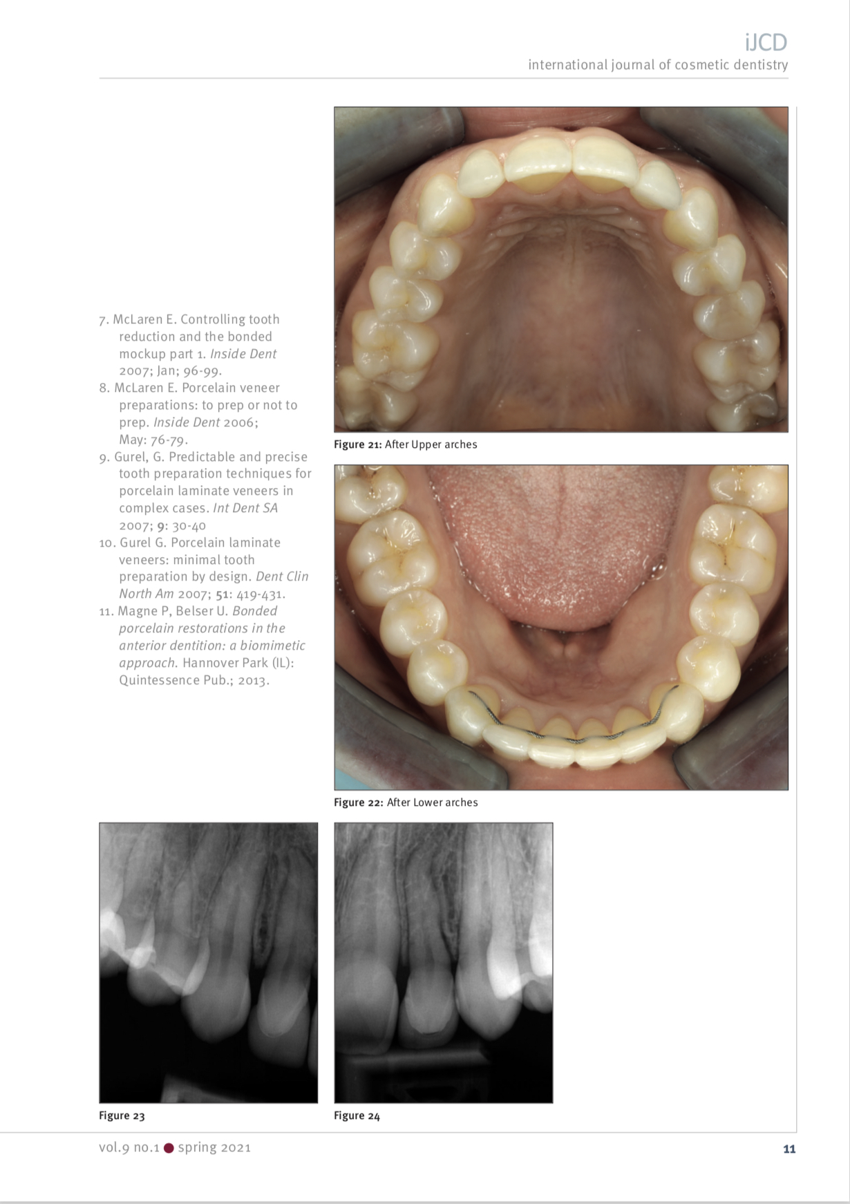 Esteettinen hammashoito Helsinki hampaat jälkeen