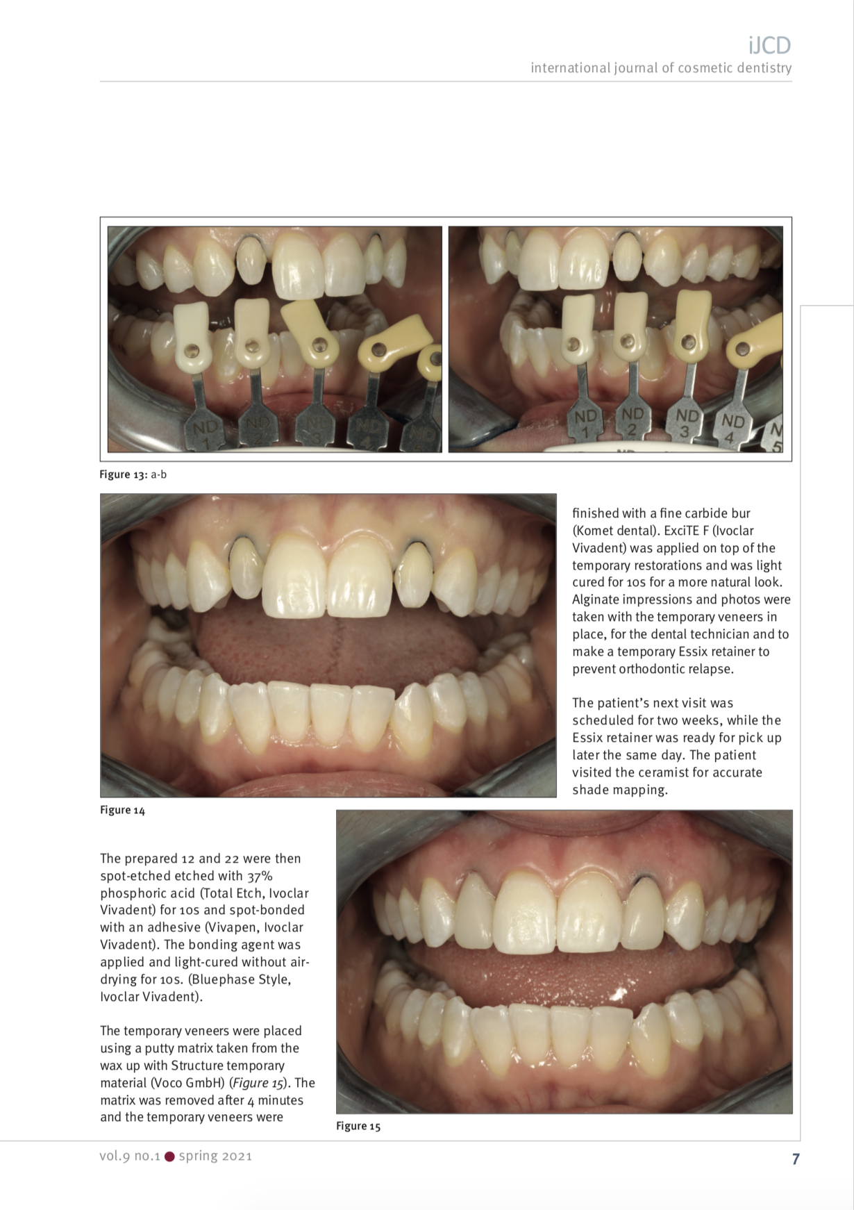 Esteettinen hammashoito Helsinki hampaat jälkeen