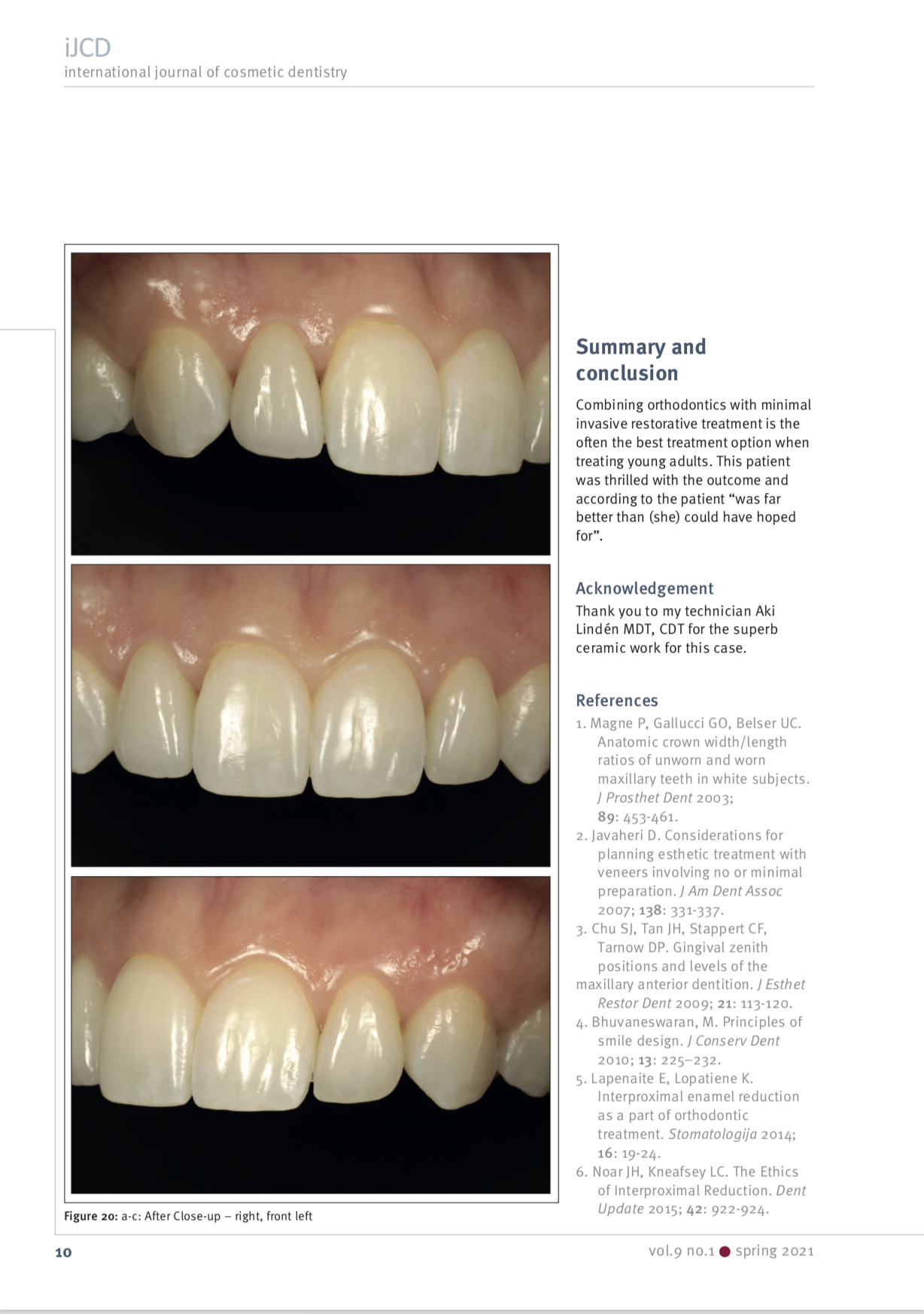 Esteettinen hammashoito Helsinki hampaat jälkeen