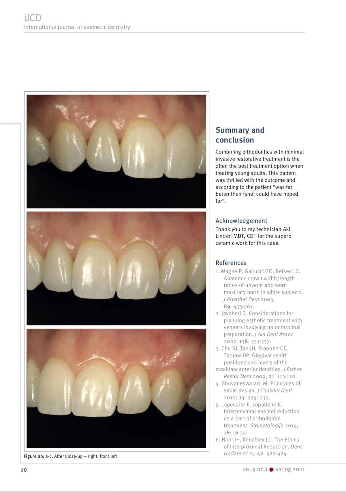 Esteettinen hammashoito Helsinki hampaat jälkeen