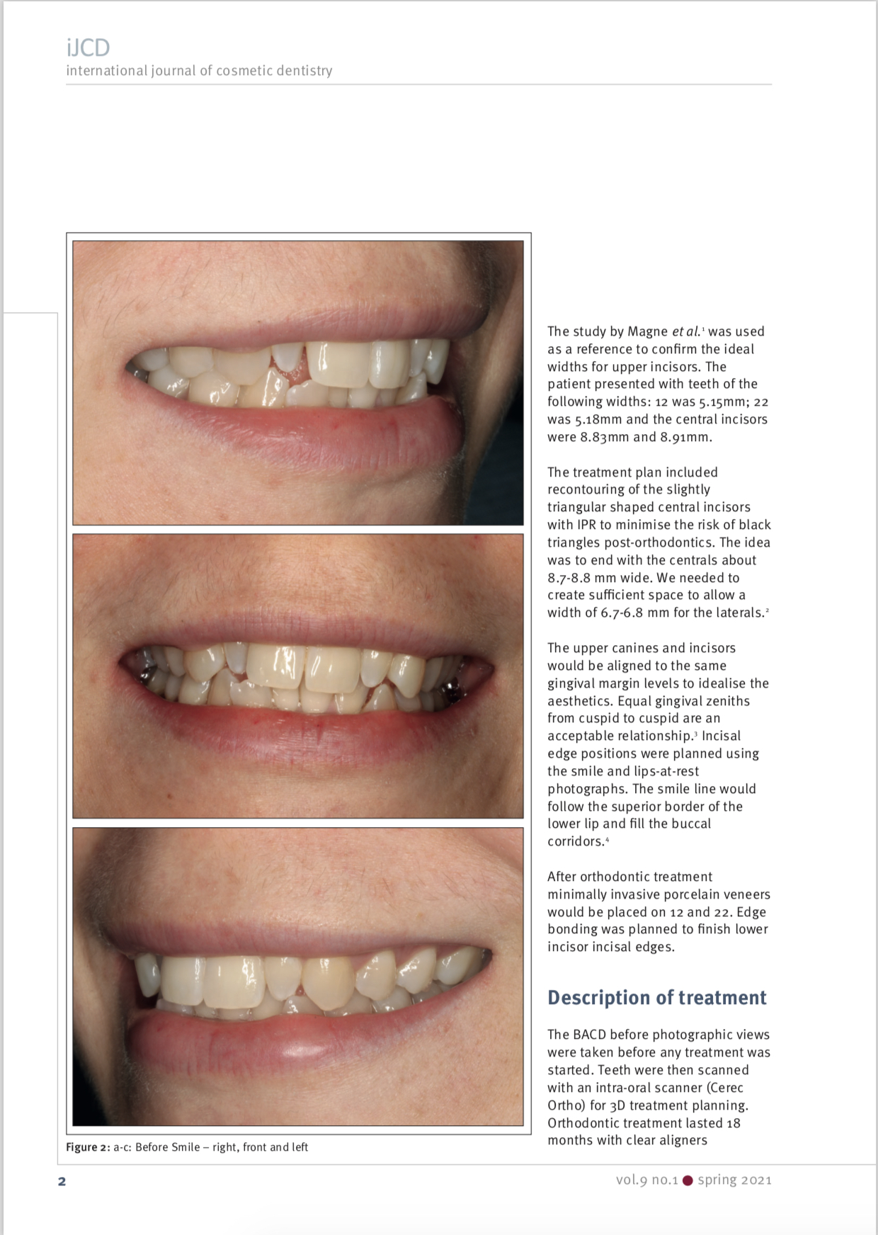 Esteettinen hammashoito Helsinki hampaat ennen