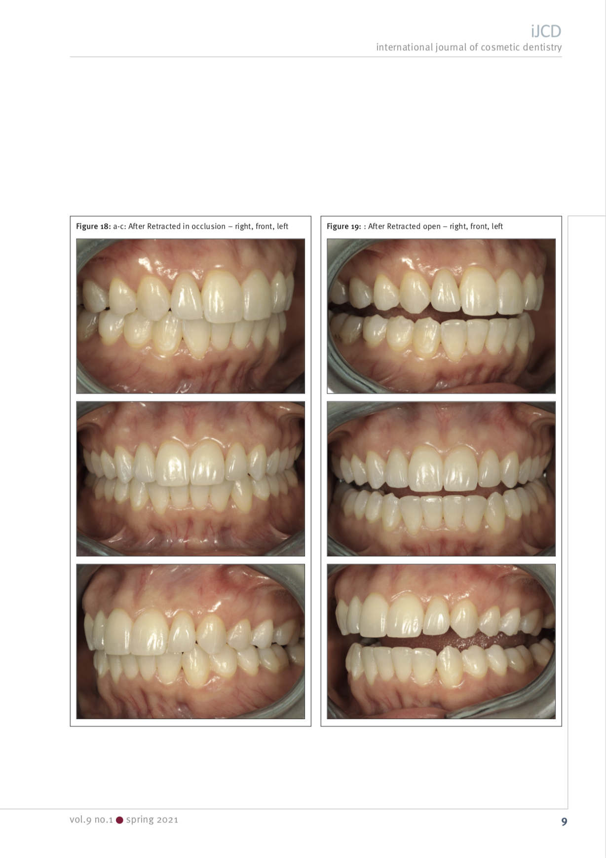 Esteettinen hammashoito Helsinki hampaat ennen