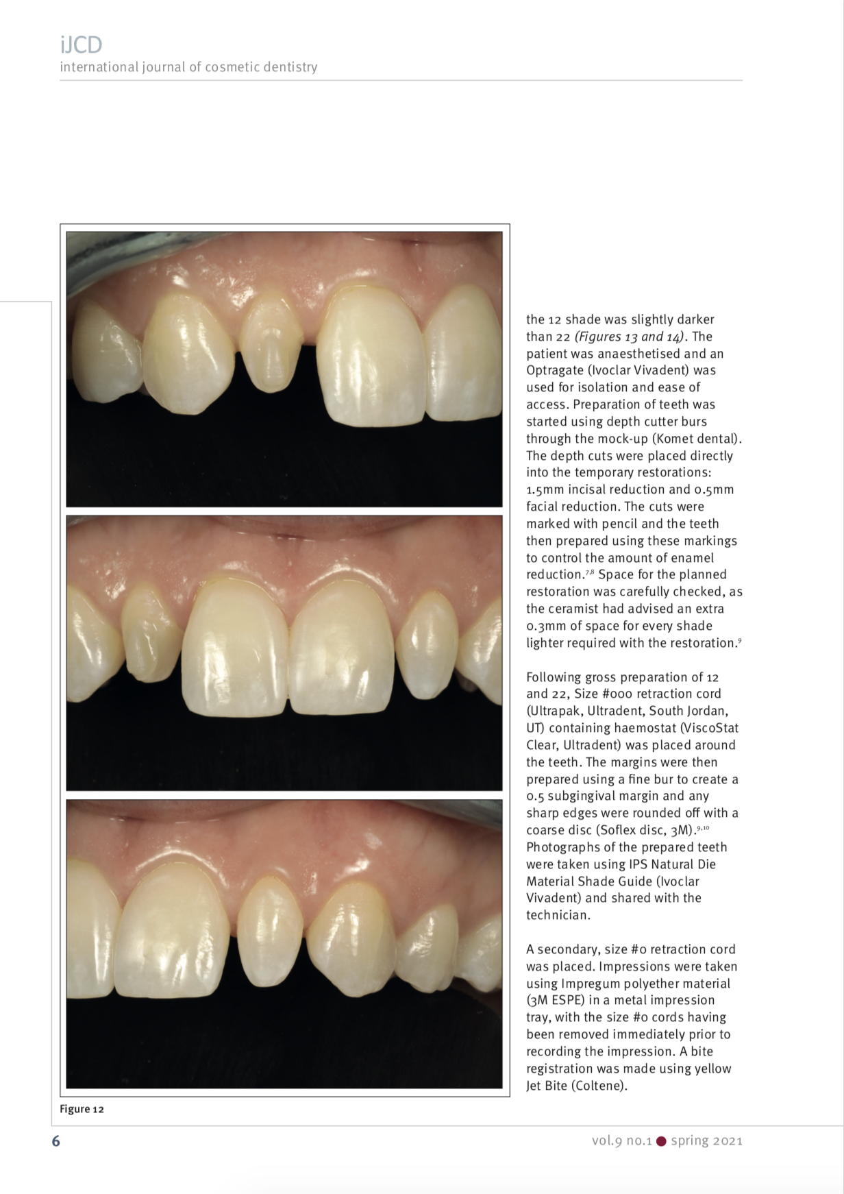 Esteettinen hammashoito Helsinki hampaat ennen