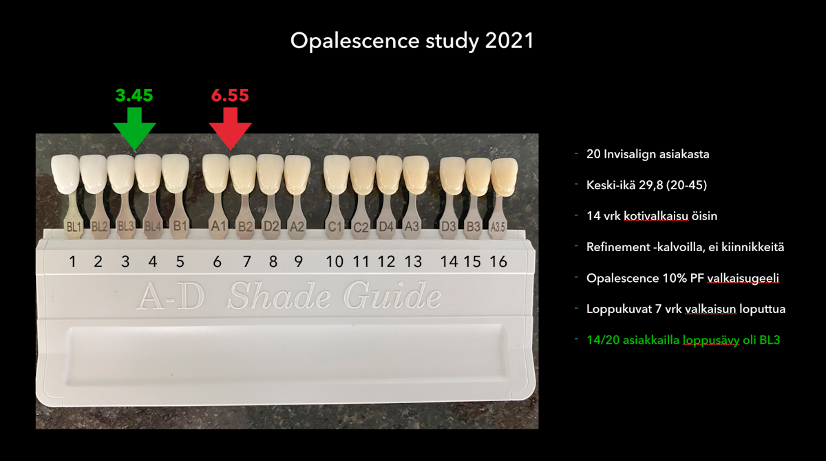 Esteettinen hammashoito Helsinki hampaat ennen