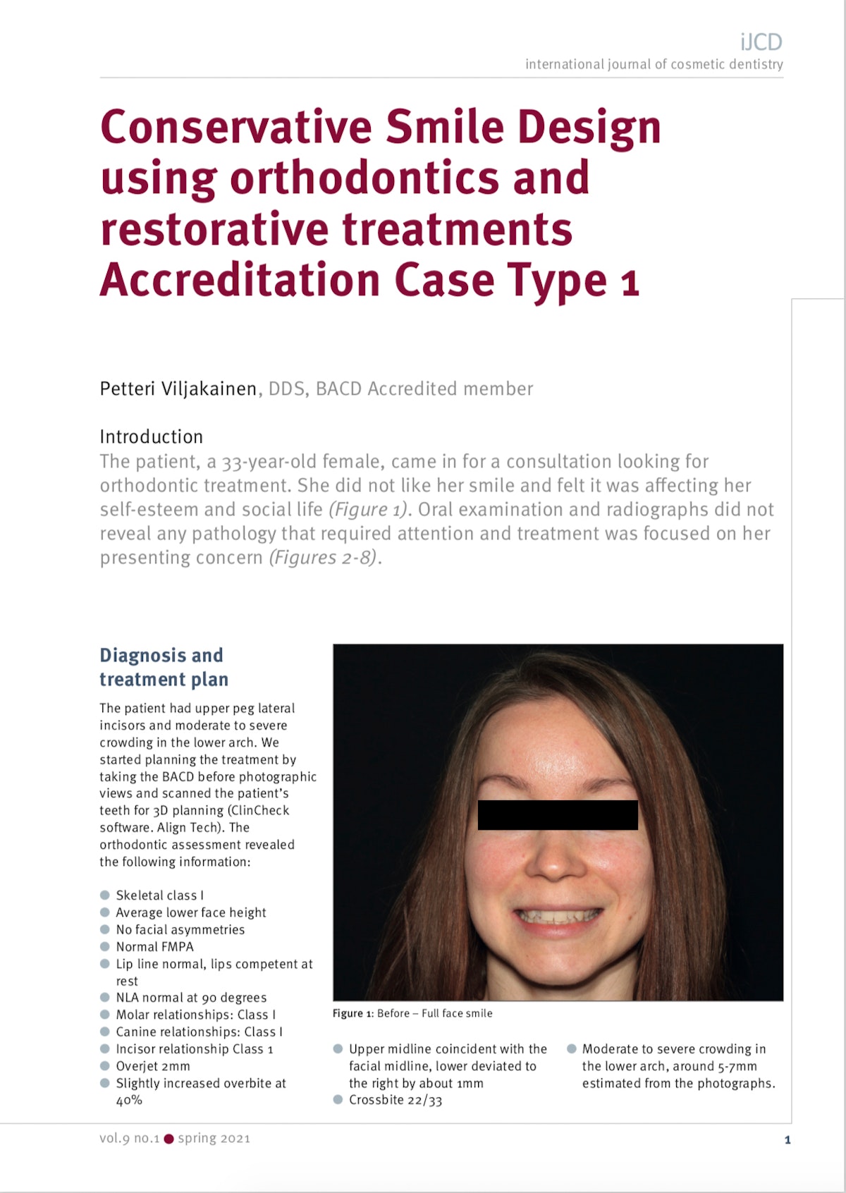 Esteettinen hammashoito Helsinki hampaat ennen