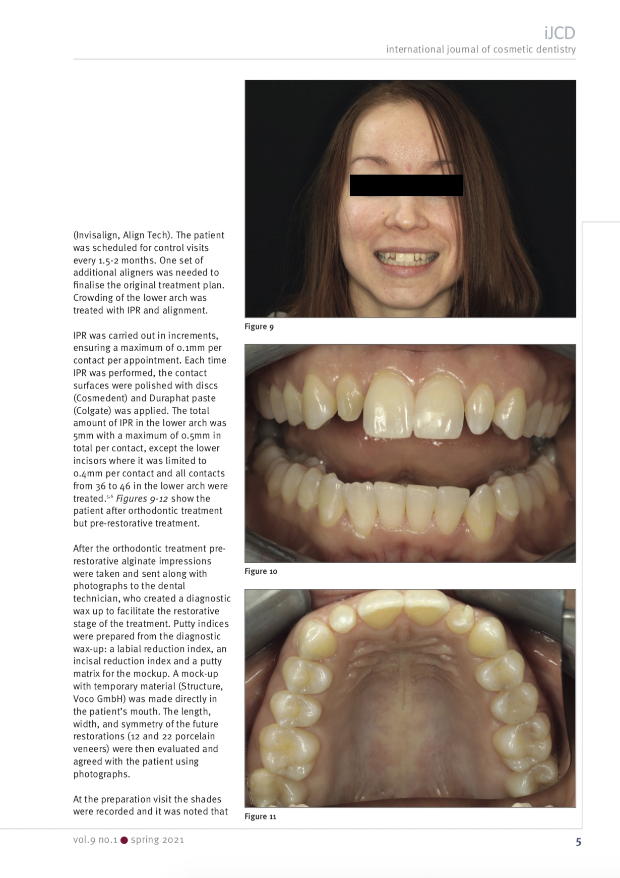 Esteettinen hammashoito Helsinki hampaat ennen