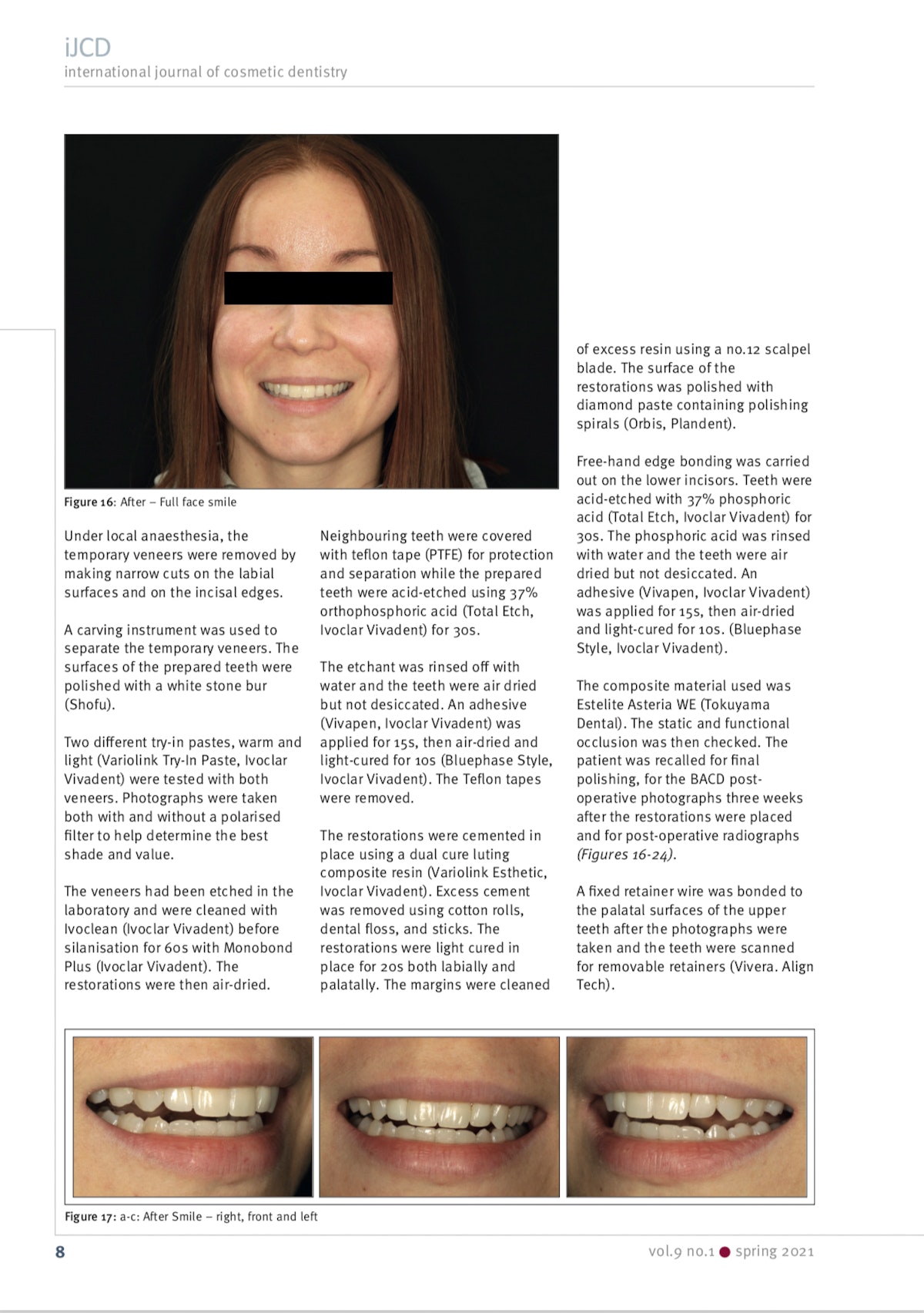 Esteettinen hammashoito Helsinki hampaat jälkeen