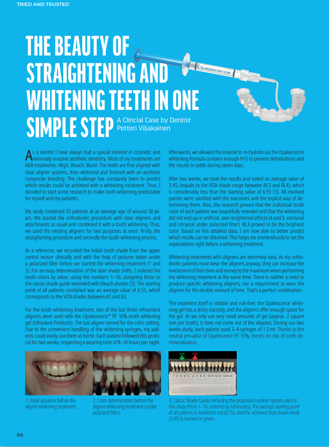 Esteettinen hammashoito Helsinki hampaat ennen