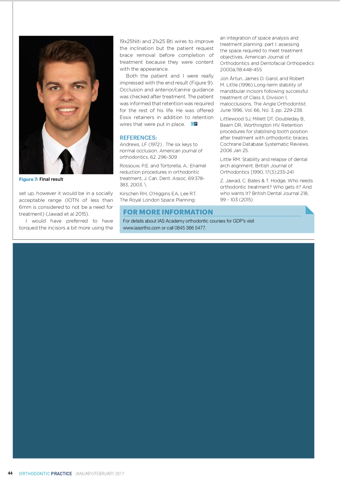 Esteettinen hammashoito Helsinki hampaat ennen