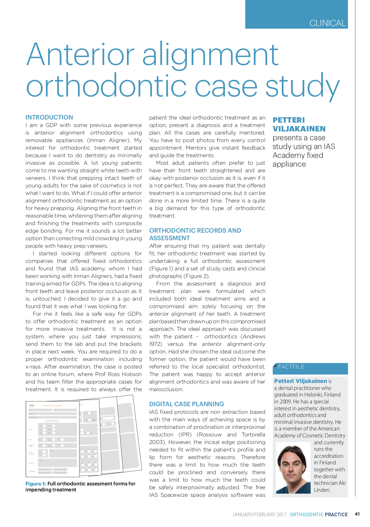 Esteettinen hammashoito Helsinki hampaat ennen