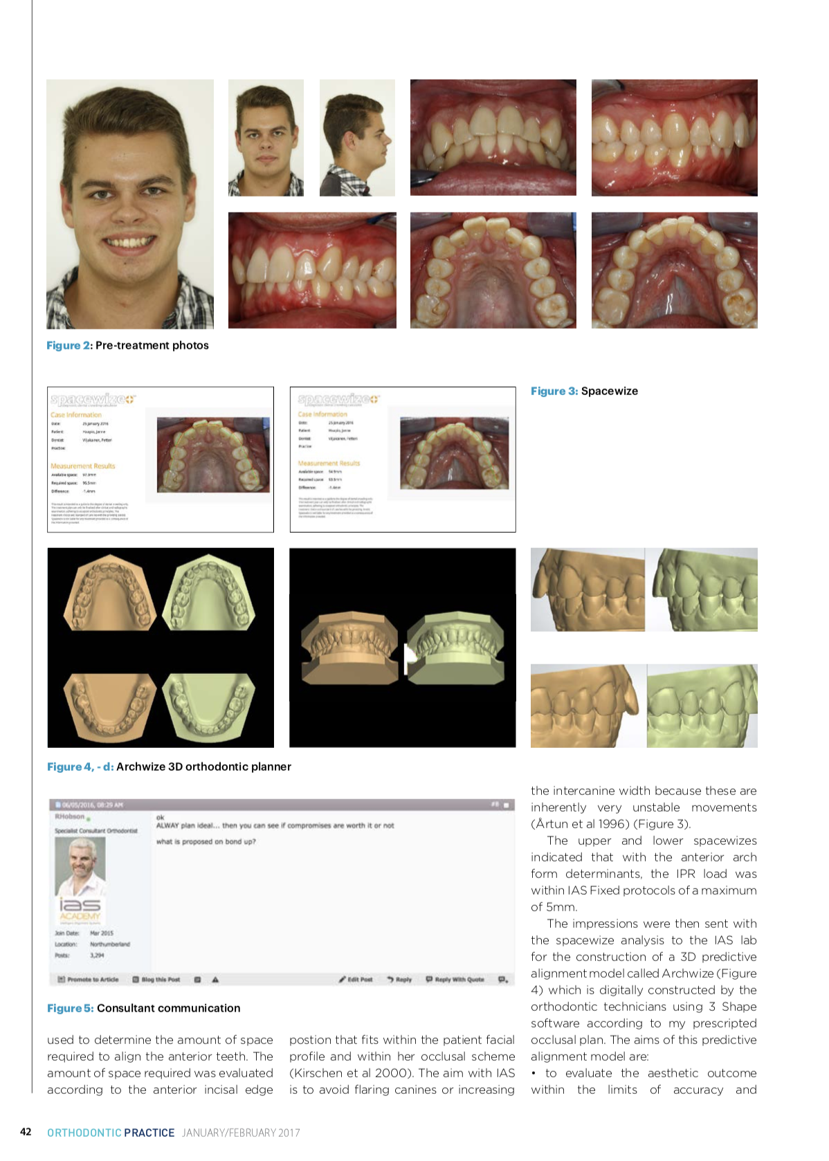 Esteettinen hammashoito Helsinki hampaat ennen