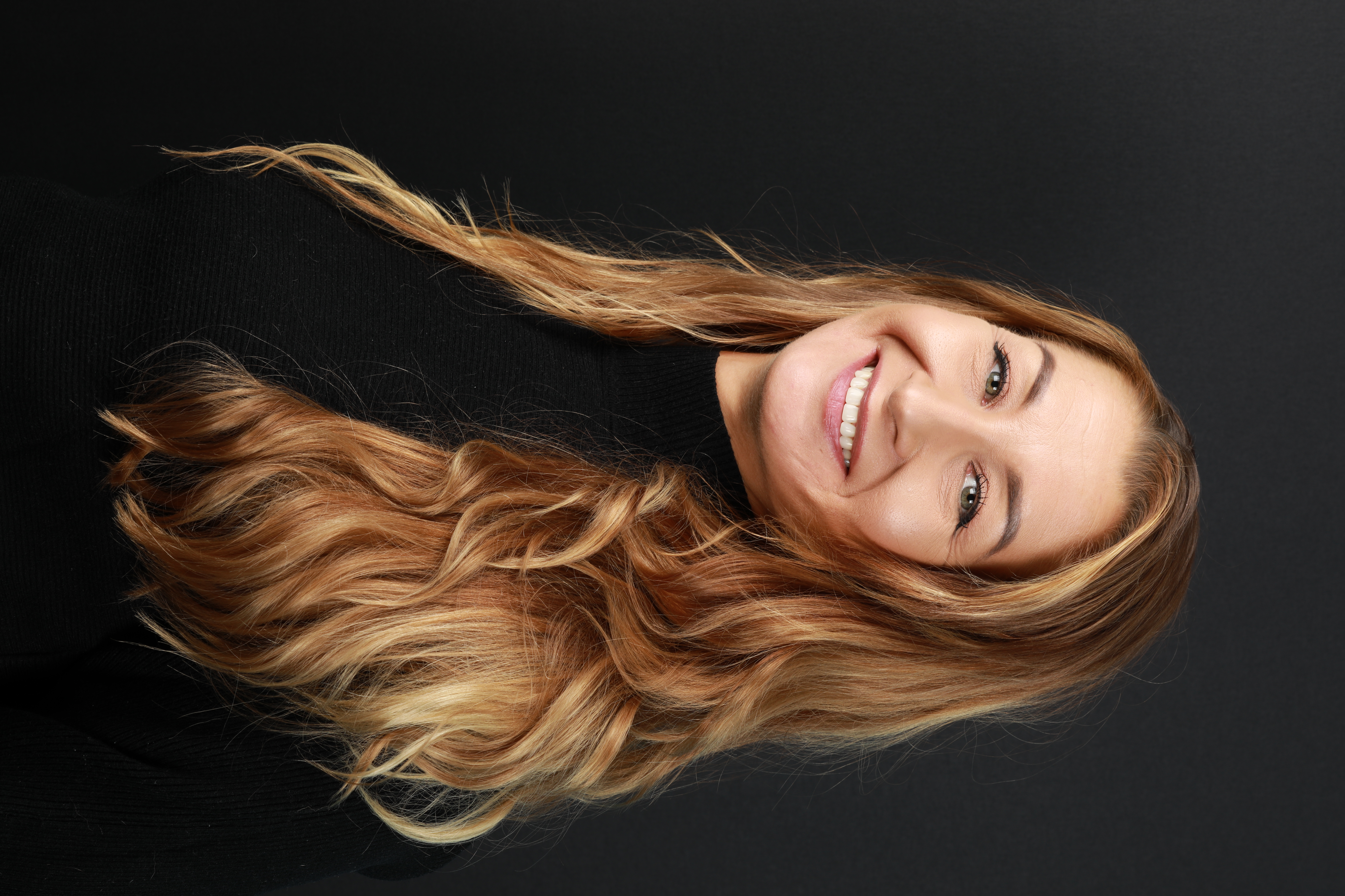 Invisalign oikomishoito jälkeen. Kahdeksaan yläetuhampaaseen tehtiin keraamiset kuoret eli hammaslaminaatit.