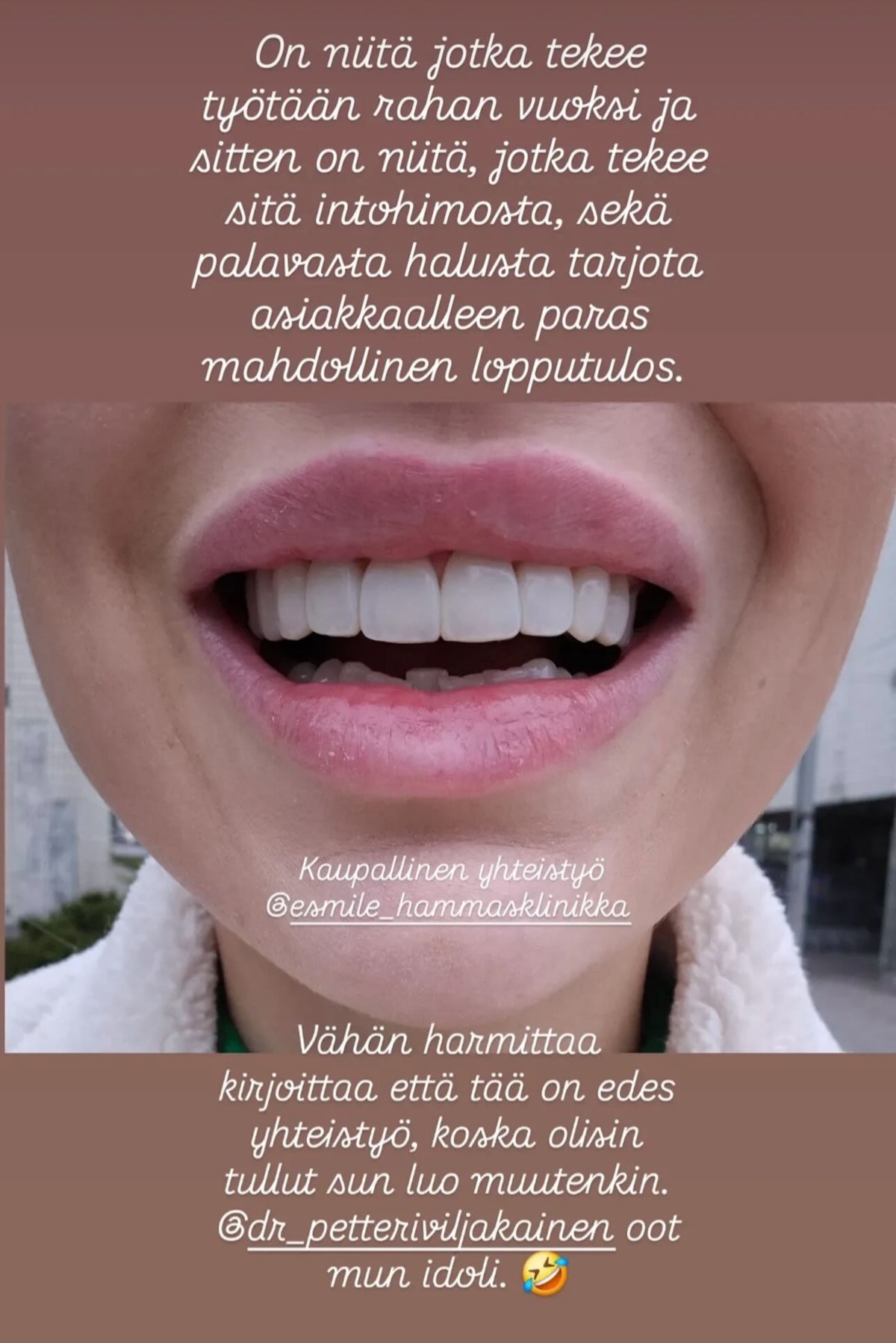 Invisalign oikomishoito ennen.