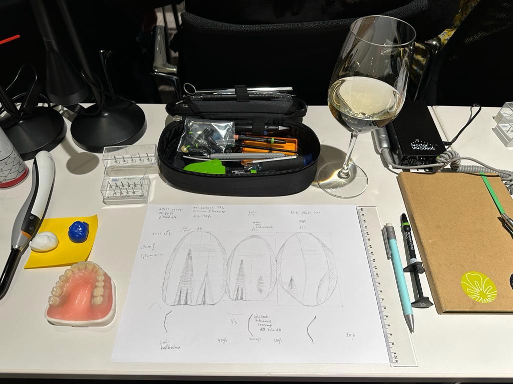 Invisalign oikomishoito ennen. Esteettiset kerrostusmuovit keskimmäisissä etuhampaissa.