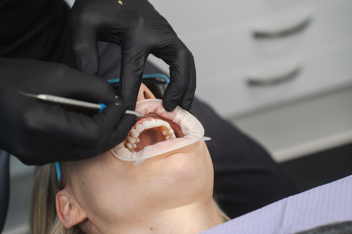 Invisalign oikomishoito ennen